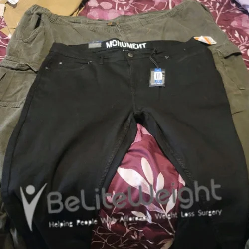 Weight Loss Surgery Gastric Sleeve before and after